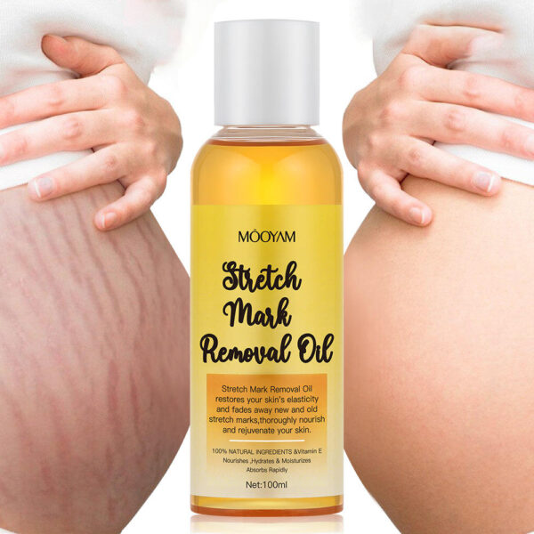 Huile Vergeture Stretch Mark – Image 2
